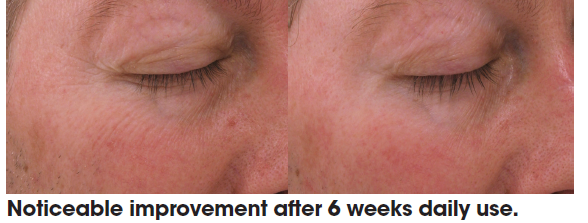 Before and after image (smoker's skin) with noticeable improvement after 6 weeks daily use | Bev Sidders Skincare