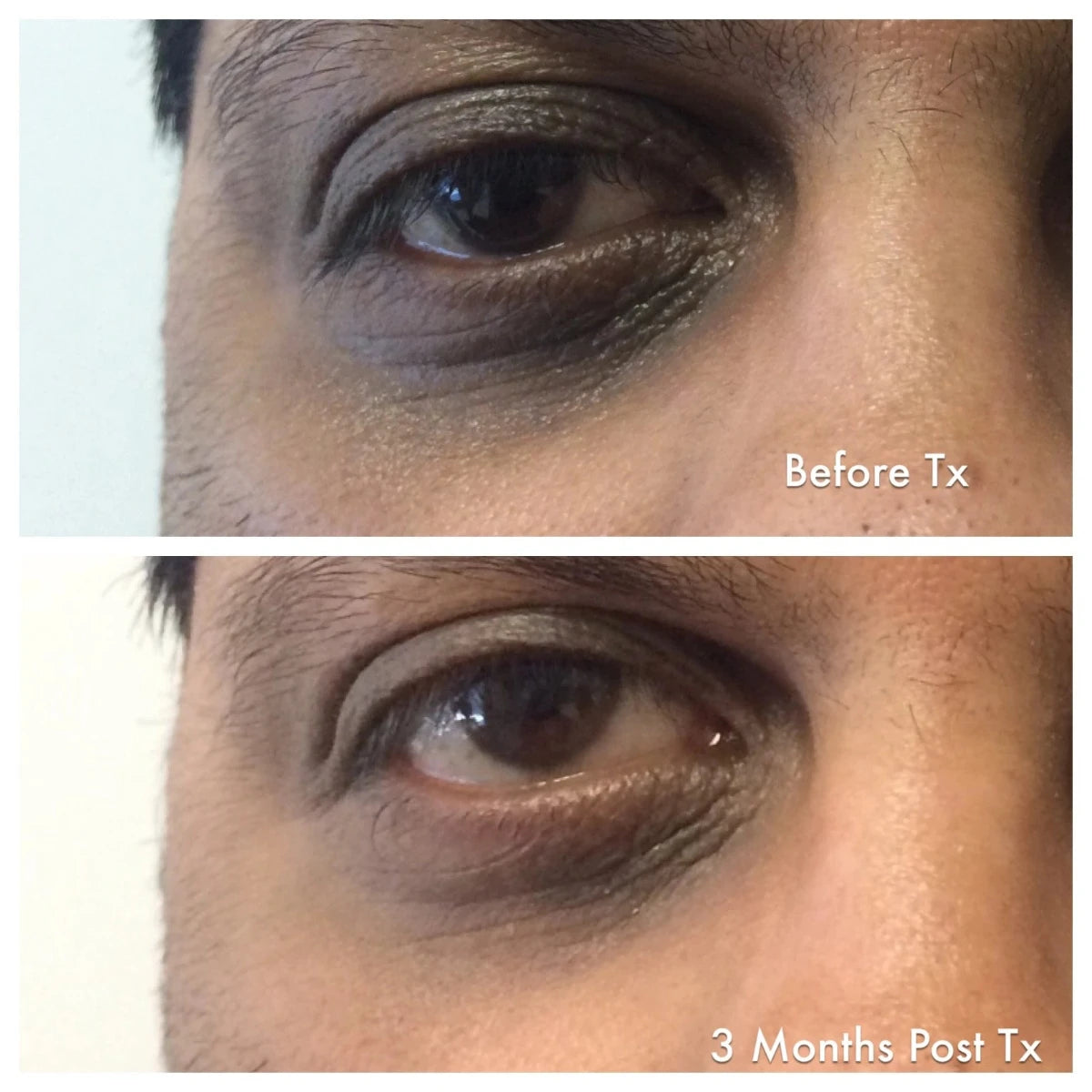 Enriched_Retinol_Eye_Repair | Bev Sidders Skincare